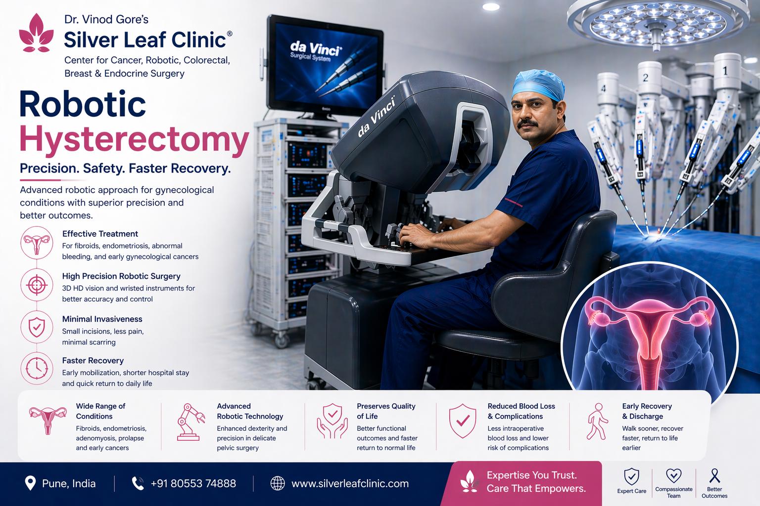Robotic Radical Hysterectomy